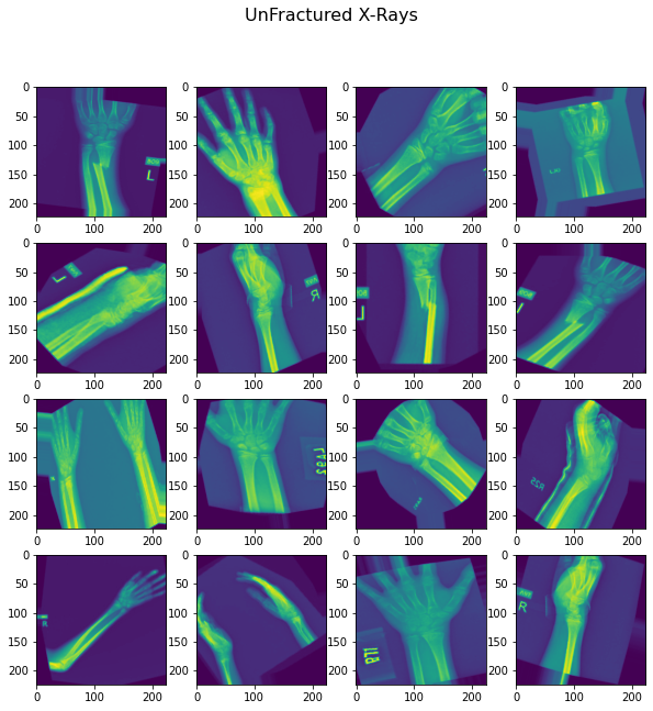 unfractured example